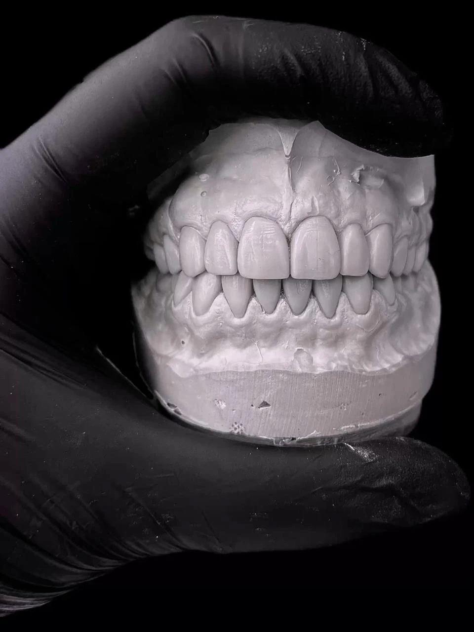 Diseño de sonrisa